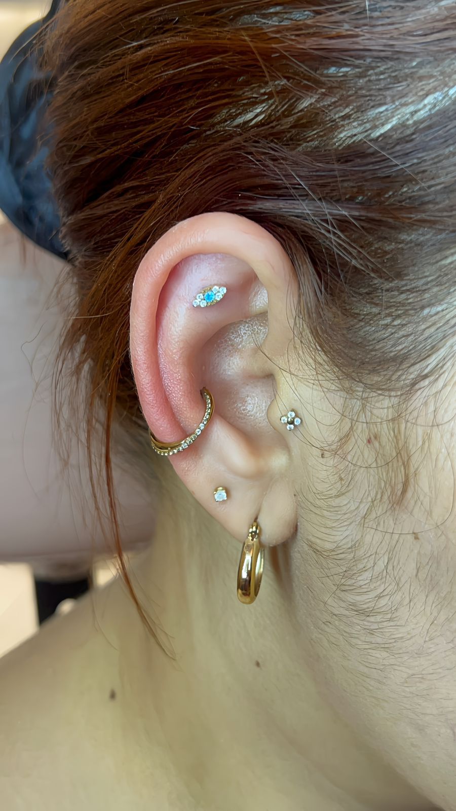 Profissional Emille Menezes realizando furo humanizado