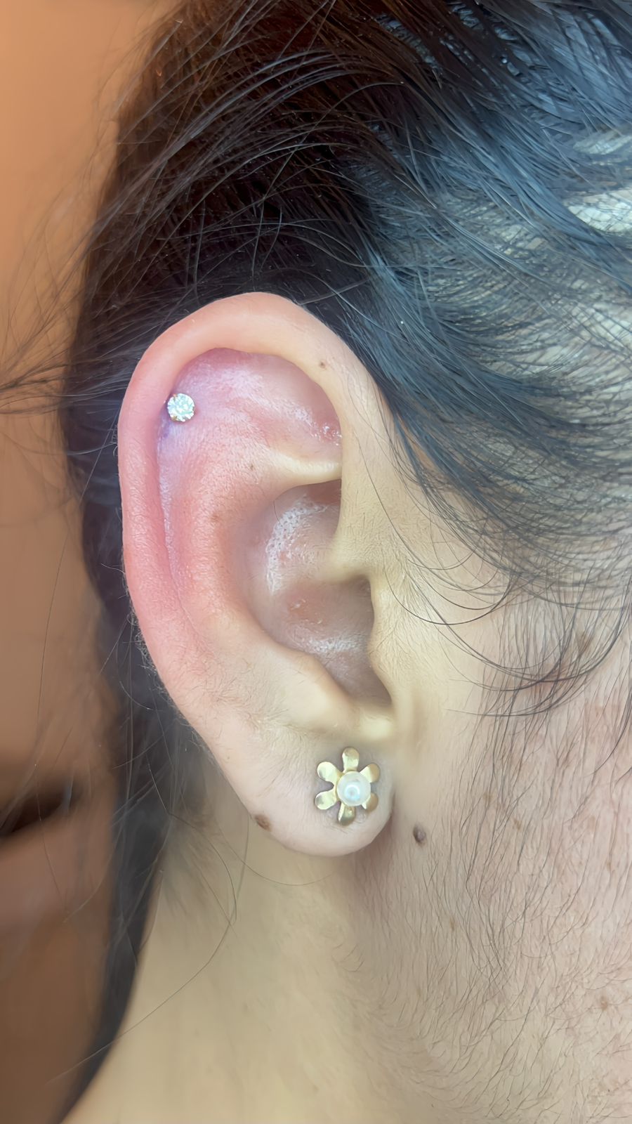 Procedimento de furo humanizado com materiais esterilizados