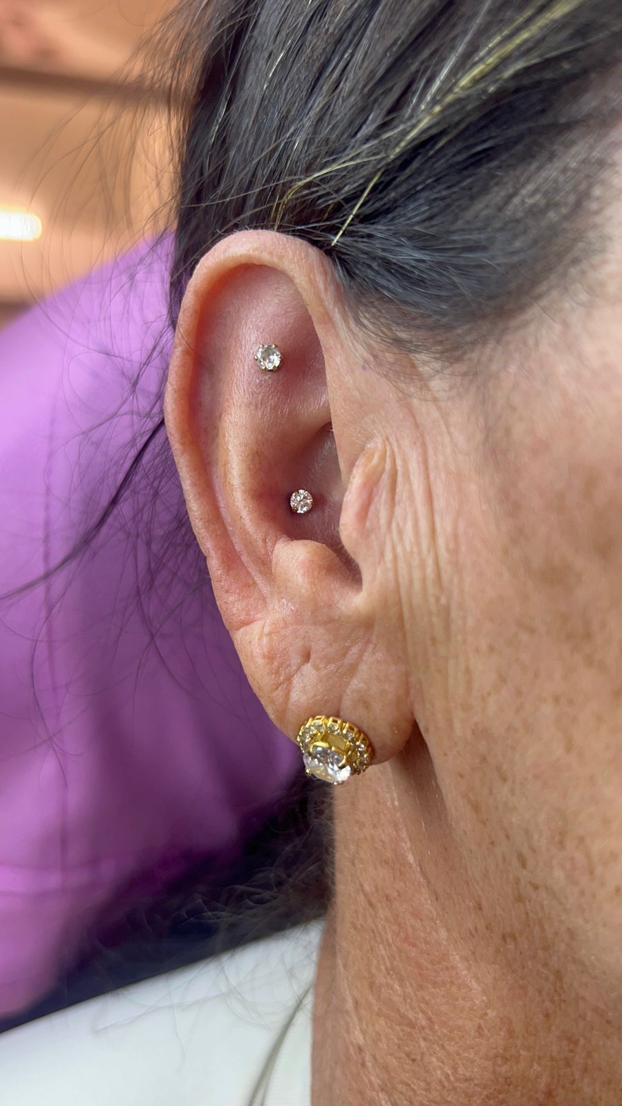 Atendimento personalizado em furo humanizado para clientes de Aracaju